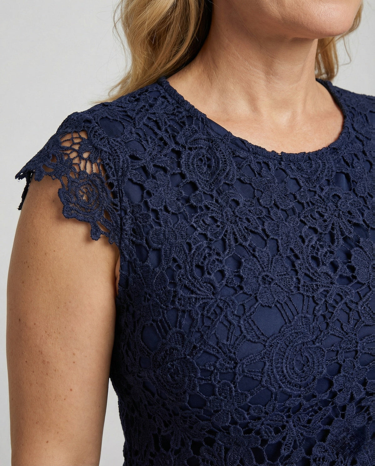 Women’s Fitted Lace Dress with Cap Sleeves and Scalloped Hem – Knee-Length Style for Weddings and Celebrations